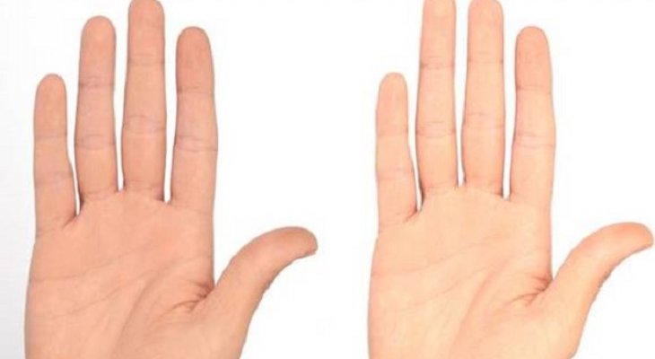 Meglepő dolog derült ki azokról a férfiakról, akiknek hosszabb a gyűrűs ujjuk! Gyűrűs ujj hossza