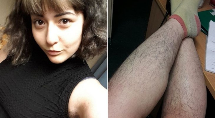 10 éve nem borotválkozik ez a nő